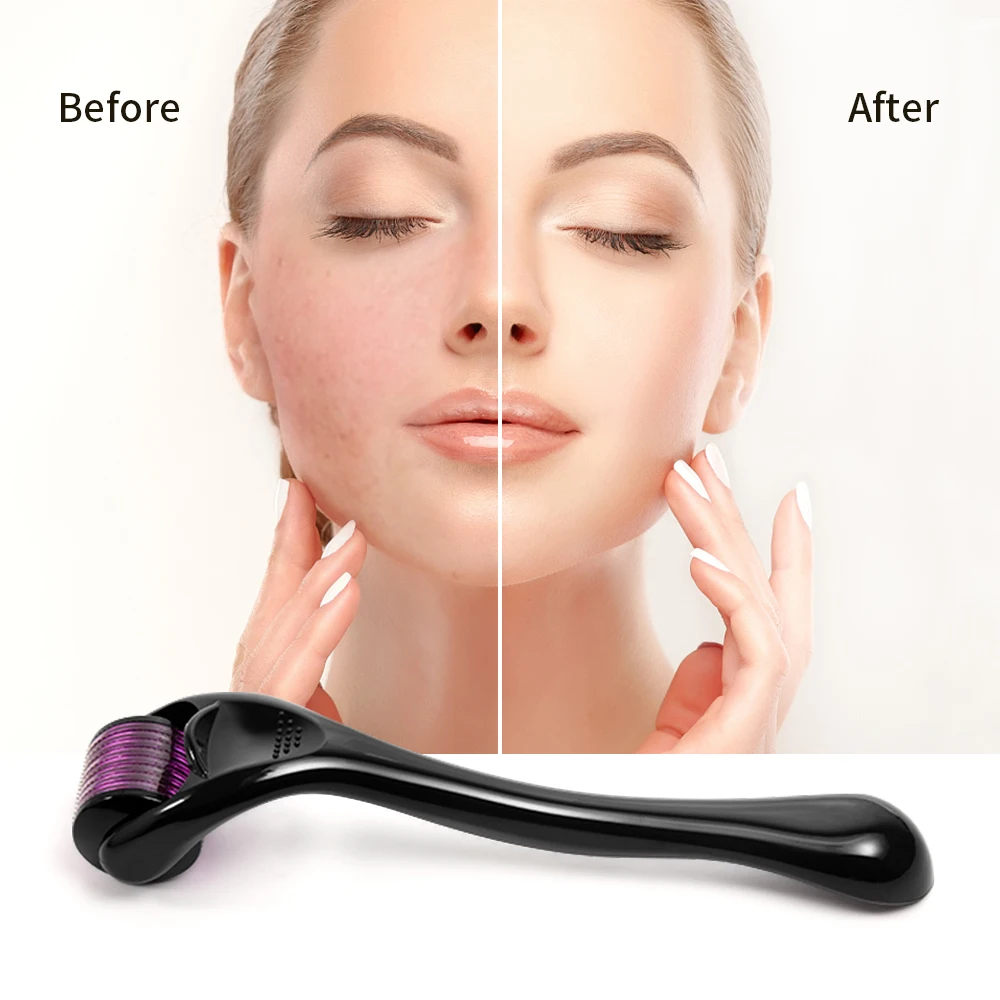 Машинка для ухода за кожей с титановыми микроиглами 540 игл |