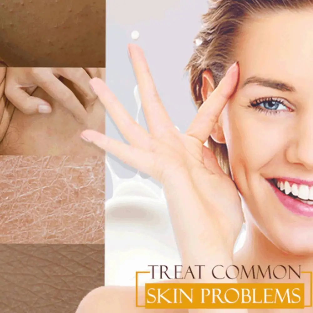 

Armpit Whitening Cream Skin Lightening Bleaching Cream Underarm Dark Skin Legs Knees Whitening Intimate Body Lotion