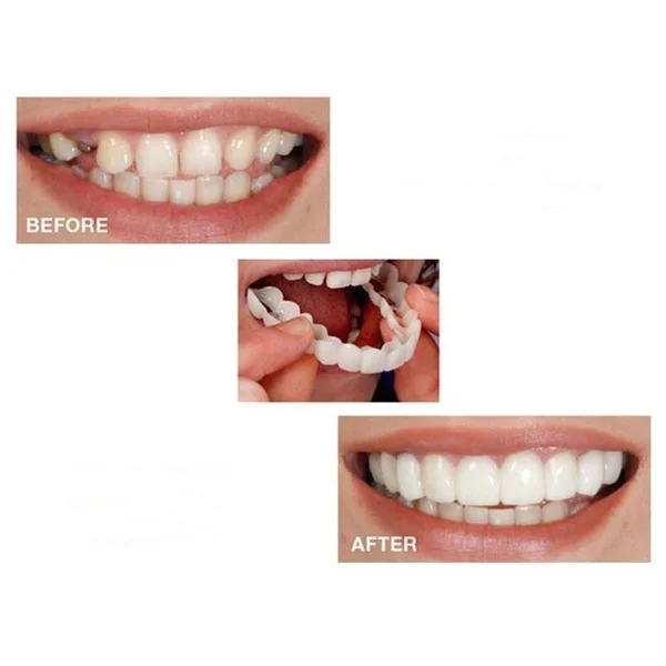

1PC Temporary Teeth Denture Teeth Top Cosmetic Dental Veneers Teeth Dentures
