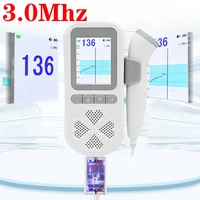chargeable 3 0mhz ultrasound fetal doppler baby heart beat 0 radiation prenata doppler baby heart rate monitor pocket doppler
