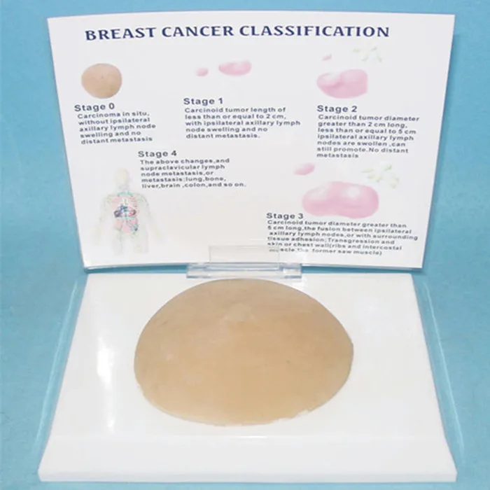 Классификация человеческого рака груди анатомическая модель гинекология