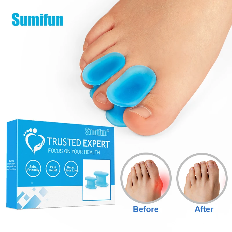 

1Set Sumifun Silicone Toes Separator Bone Ectropion Adjuster Toes Outer Appliance Big Hallux Valgus Corrector Foot Care Tools