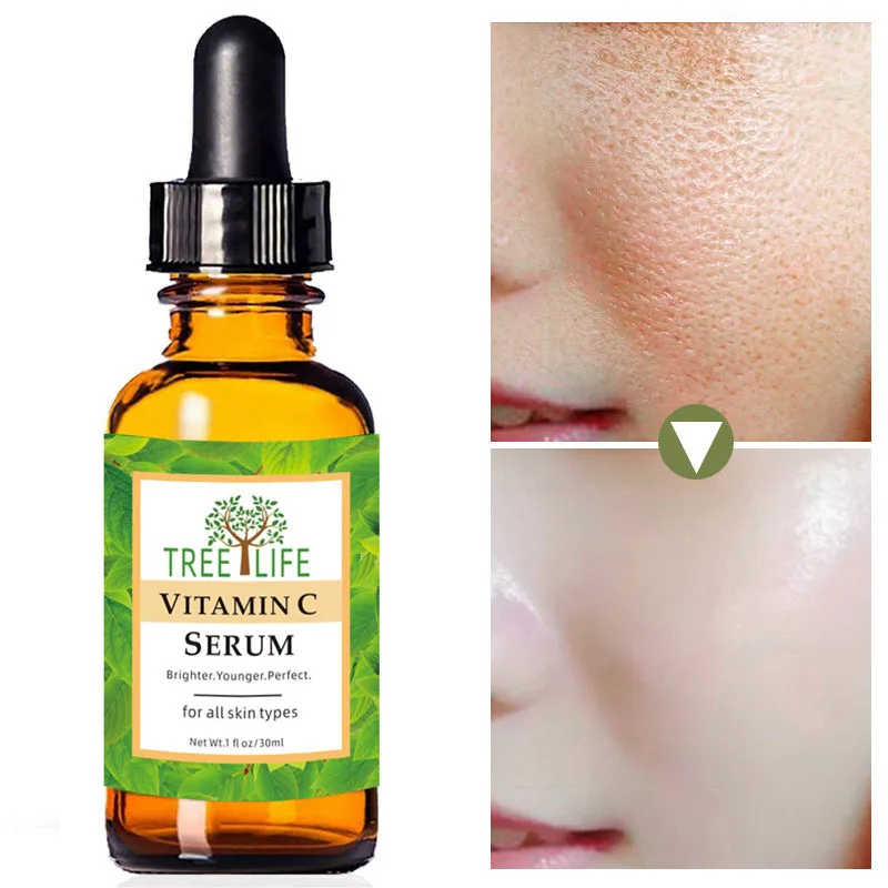 

Vitamin C Whitening Face Serum Fade Freckle Lighten Spots Brighten Facial Skin Essence Care Anti Aging Moisturizing Remove Speck