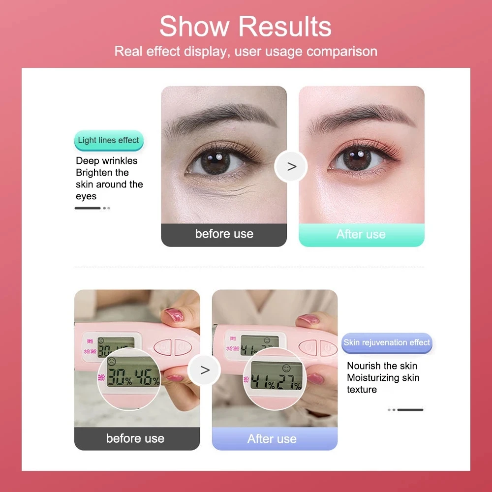 

New RF EMS Beauty instrument Women face care tool Eye care tools Beauty machine Skin care device Beauty Devices