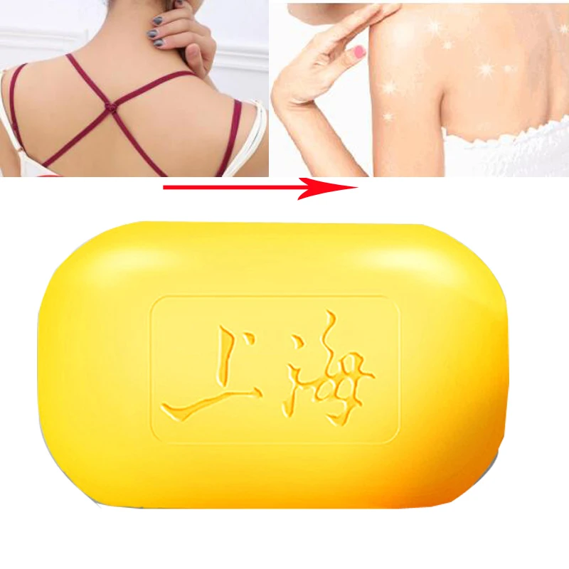 Шанхай серное мыло для жирной кожи лечение акне удаления душек 85 г Отбеливающее