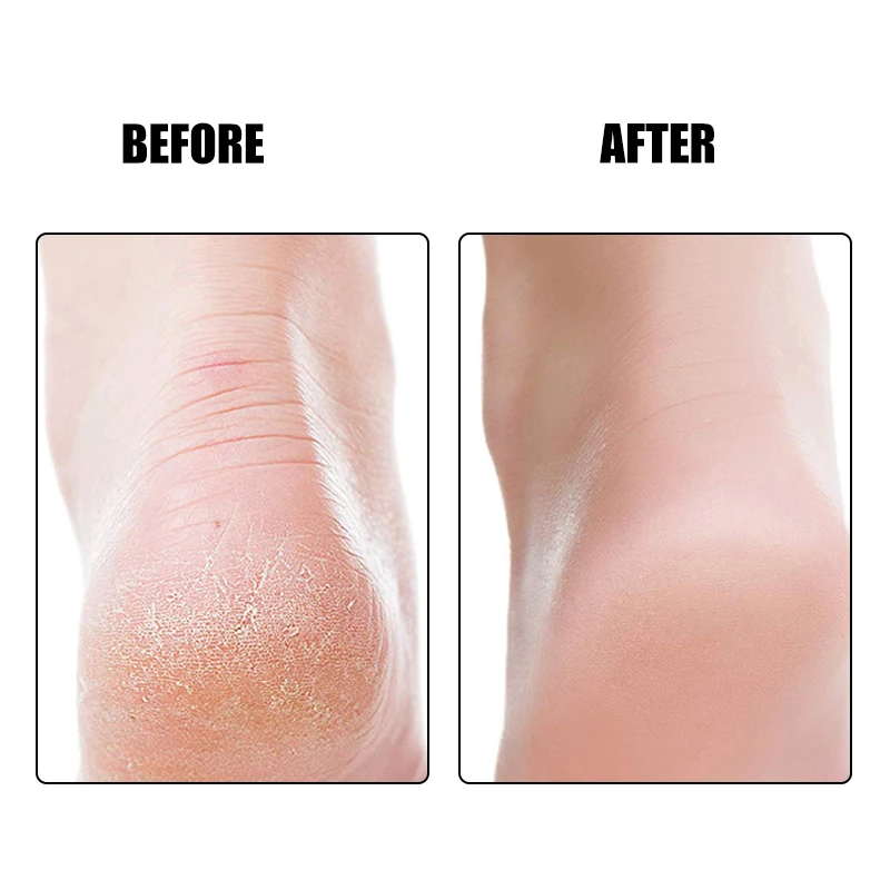 Пемза для отшелушивания ног массажный продукт мертвой кожи щетка чистки ступней