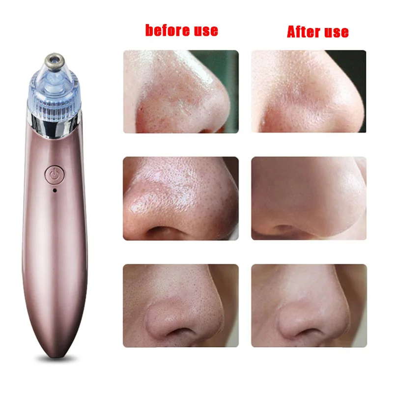 

Facial Blackhead Removal Machine for Aspiration Acne Suction for Pore Cleansing Skin Care M2