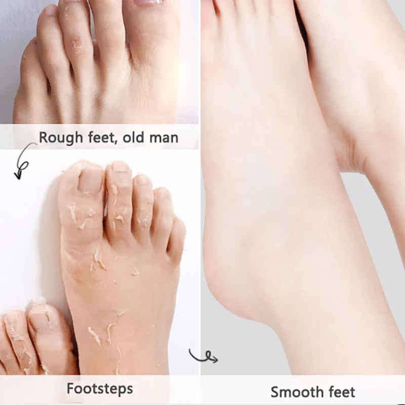 2 пары детских масок для удаления омертвевшей кожи маска ног отшелушивающая
