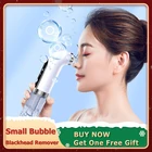 Приспособление для удаления черных точек, инструмент для удаления черных точек, акне, прыщей, перезаряжаемый вакуумный очиститель пор, очистки воды, цикла носа, лица