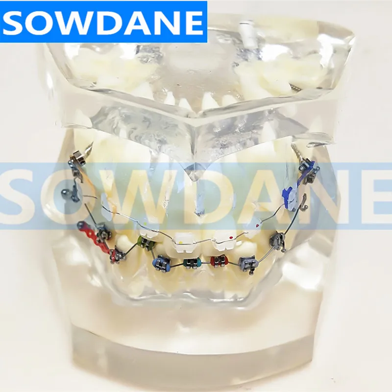 Прозрачная Стоматологическая Ортодонтическая модель для прикуса с двумя видами