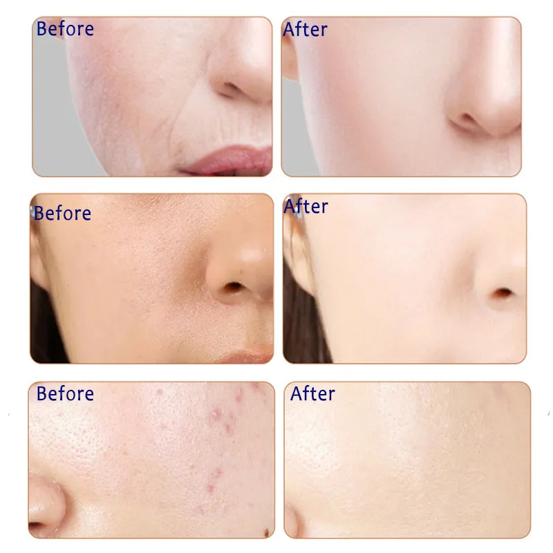 10 шт. улитка маска для ухода за кожей лица увлажняющая уход отбеливание контроль