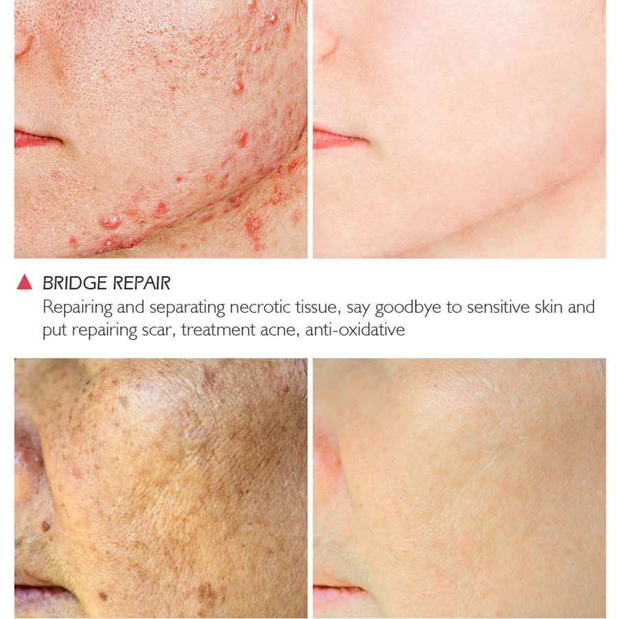 Яркий гламурный Тоник для лица крокодила восстанавливающий шрам сыворотка