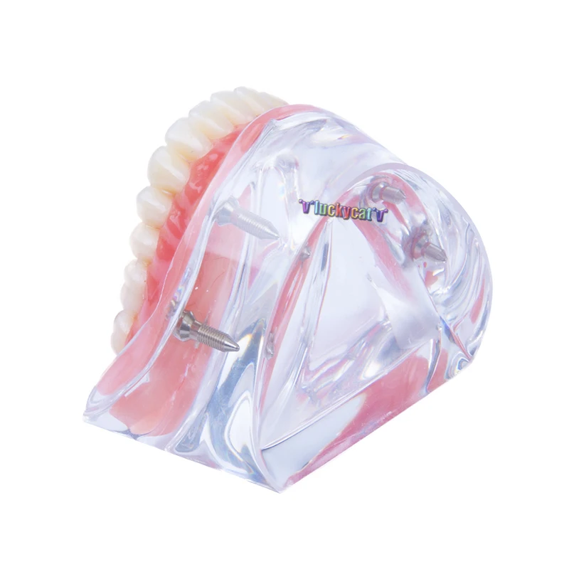 Модель зубного протеза съемная внутренняя модель нижних зубов Mandibular с