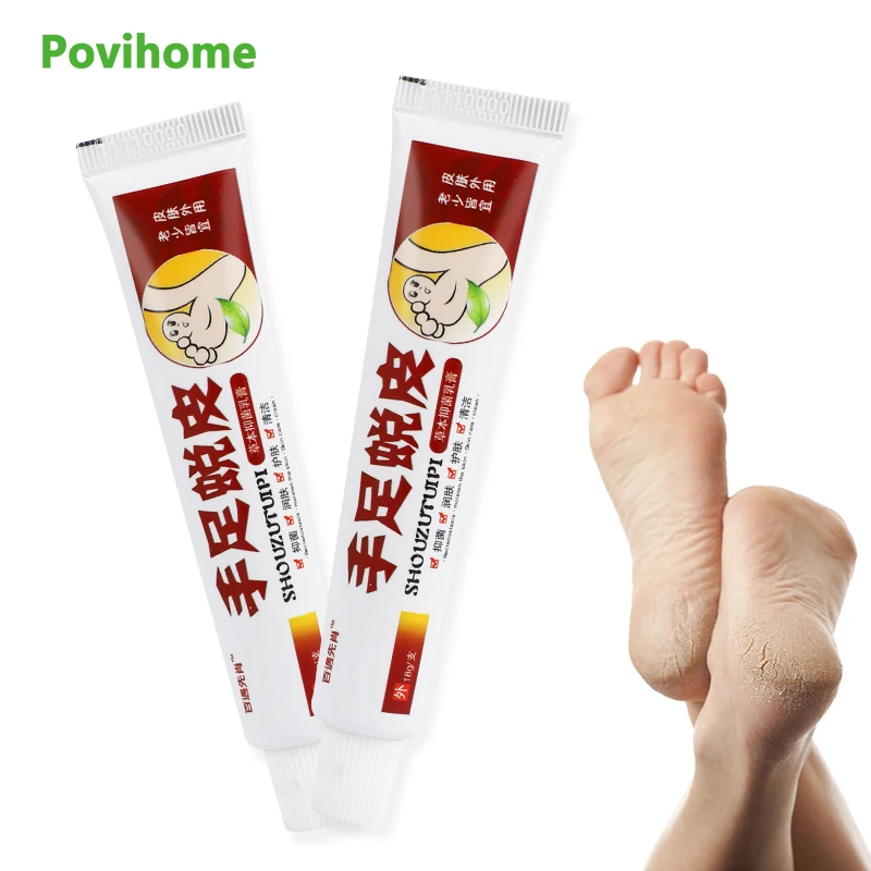 

18g/pc Remove Dead Skin Foot Cream For Dry Hand Herbal Cream Antibacterial Ointment Heal Crack Repair Skin Itching Health Care