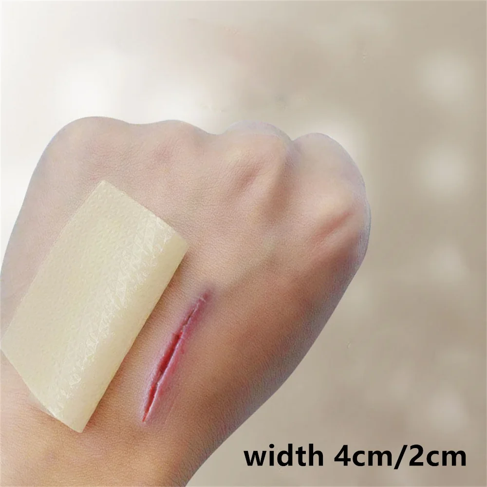 Эффективное хирургическое средство для удаления шрамов пластырь лечения травм