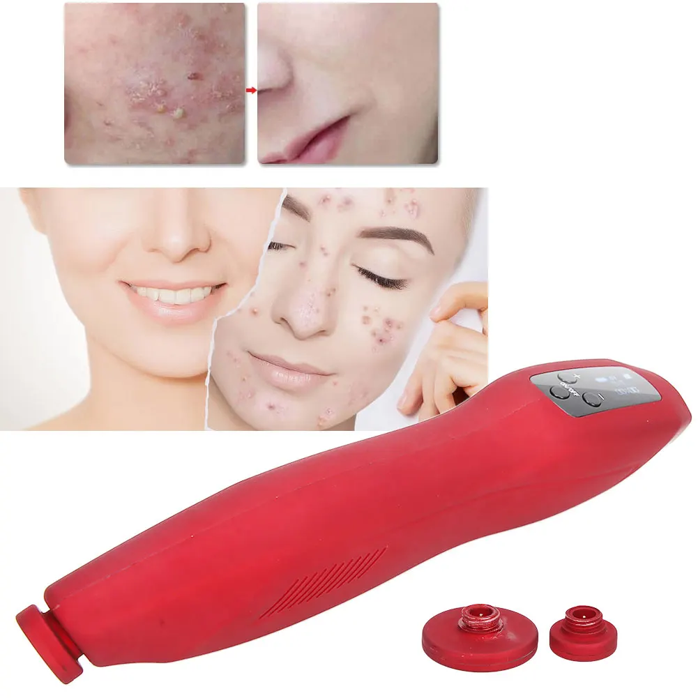 Инструмент для красоты устройство удаления акне USB мини LedPhoton укрепляющее