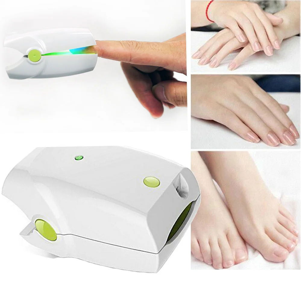 Для домашнего использования Лечение грибка ногтей лазерная терапия онихомикоз