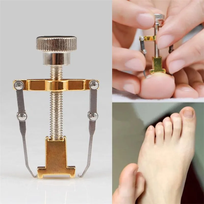 Ingrown Toenail Corrector Pedicure Fixer Foot Nail Care Orthotic Stainless Steel Treatment Bunion Correction Tool | Красота и