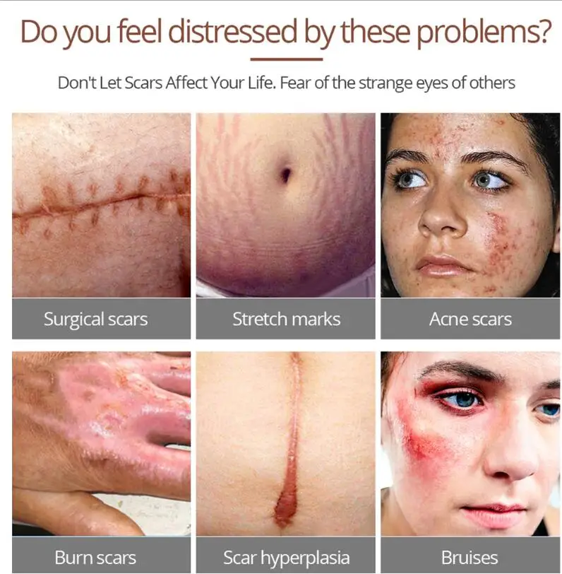 Эссенция для замены кожи крокодила | Красота и здоровье