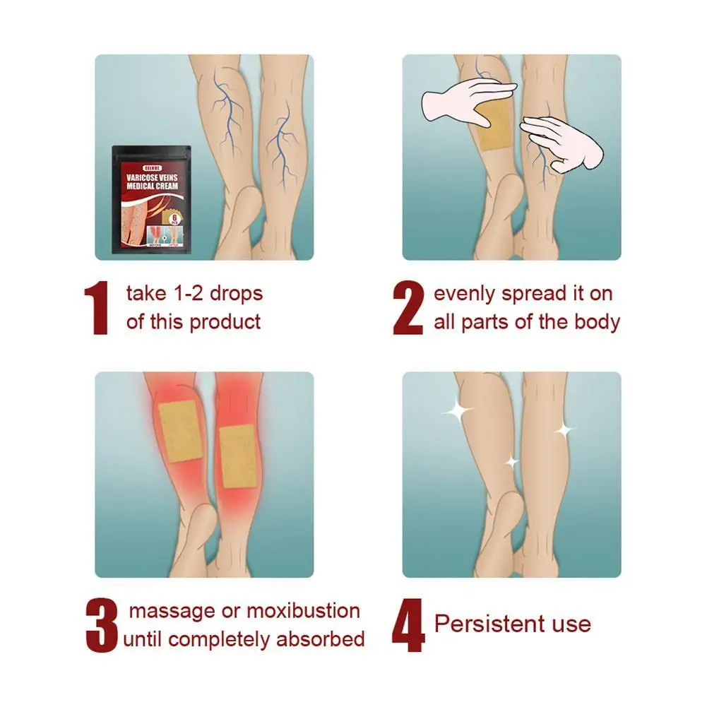 Варикозное расширение импульсный черный пластырь китайские варикозное вен