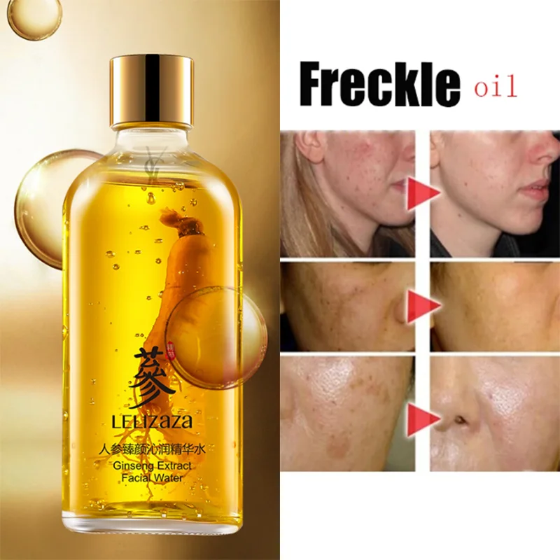 

Эссенция женьшеня для удаления веснушек, 100 мл, Увлажняющая восстанавливающая Антивозрастная осветляющая отбеливающая Сыворотка для удале...