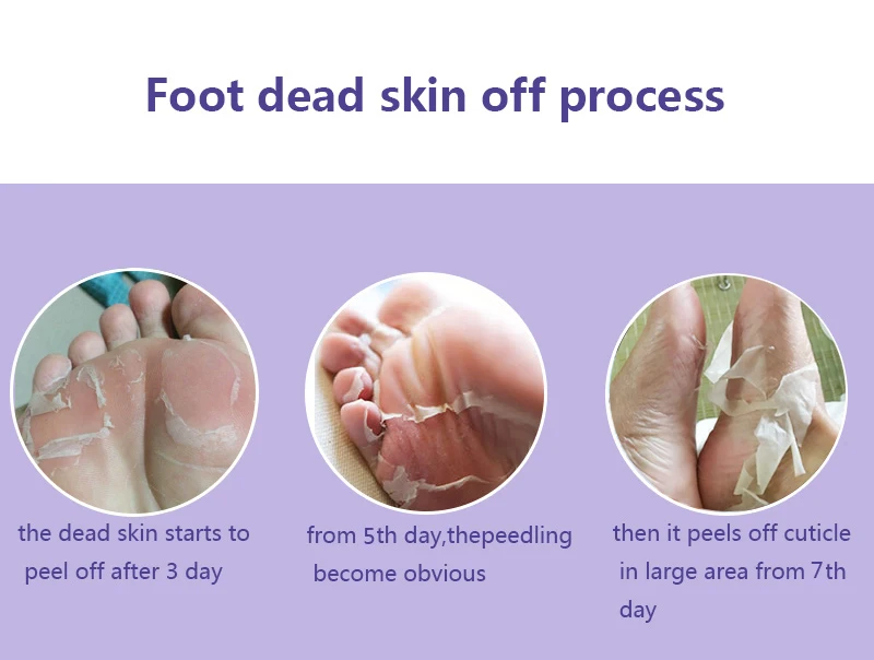 1pair=1pack EFERO Exfoliate Foot Mask Pedicure Socks Exfoliation for Feet Remove Dead Skin Heels Peeling Legs | Красота и здоровье