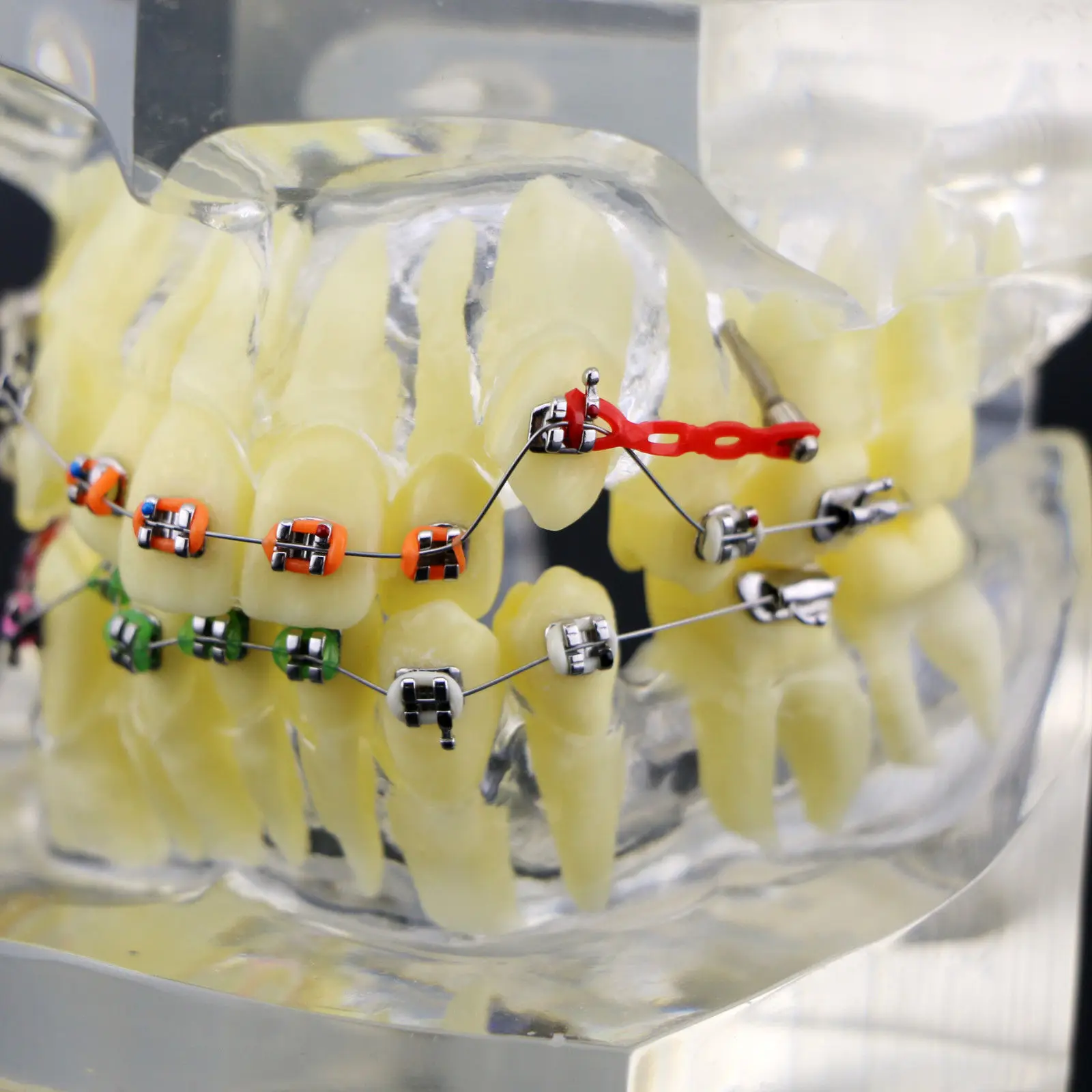 1 шт. Ортодонтическая зубная терапия модель прикуса с цепной проволокой #3005