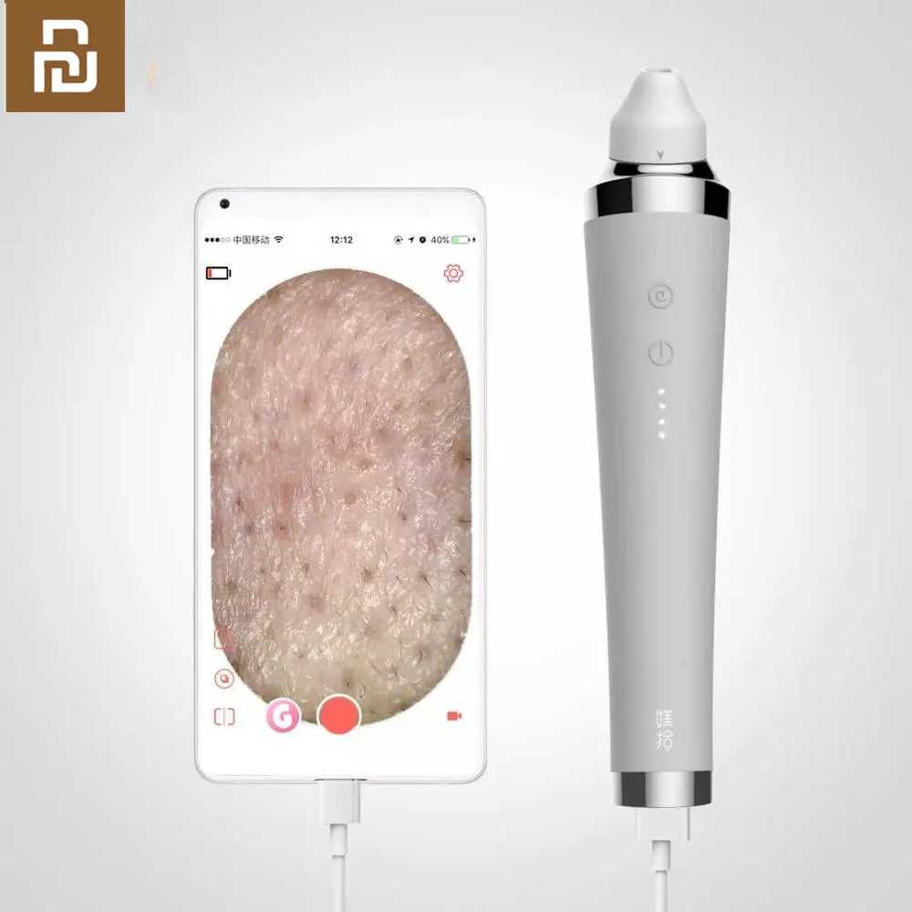 Xiaomi Youpin Электрический визуальный прибор для удаления акне вакуумный черных