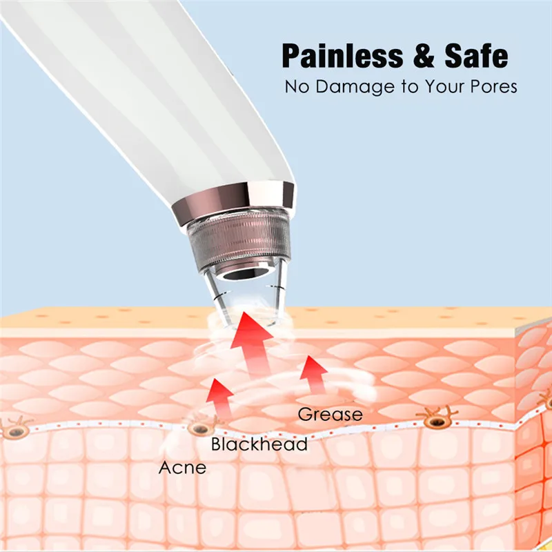 Нагрева для удаления угрей вакуумный аппарат очистки пор Электрический нос Уход