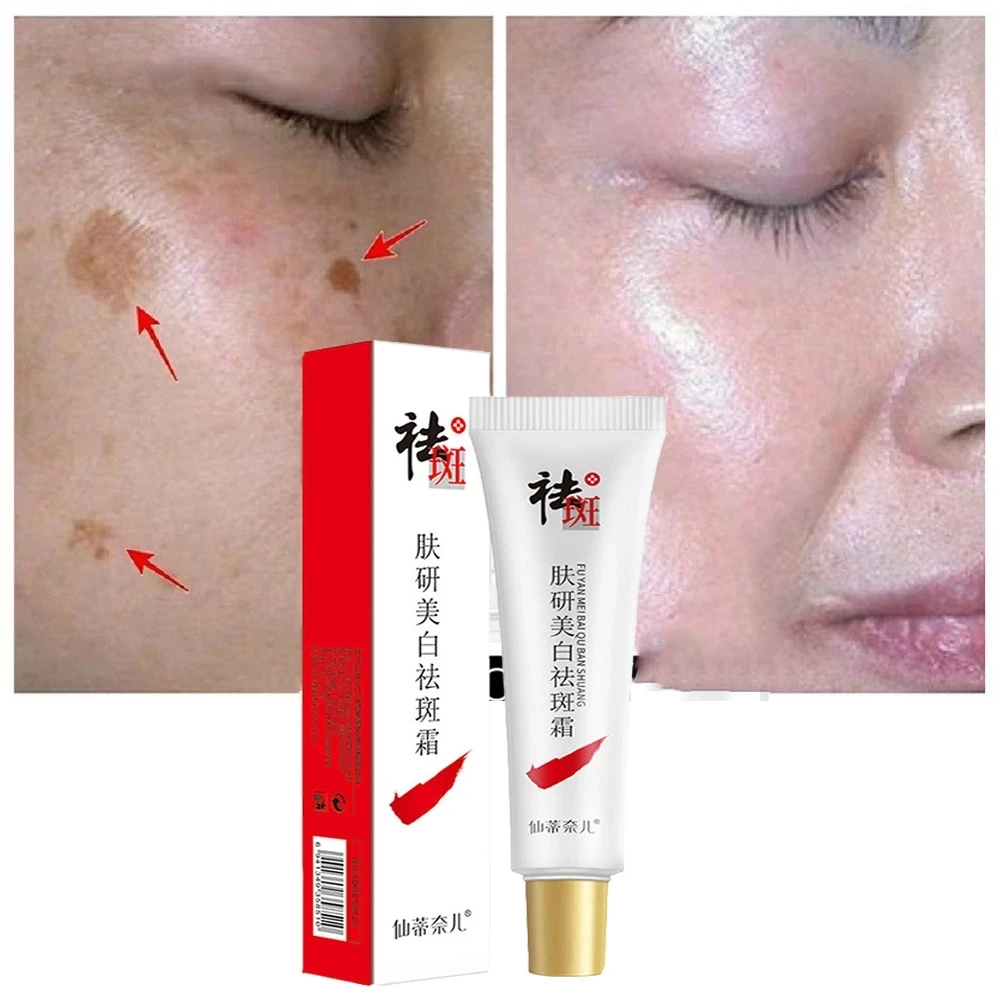

Effective Whitening Freckle Face Cream Remove Melasma Acne Spot Pigment Melanin Dark Spots Pigmentation Moisturizing Skin Care