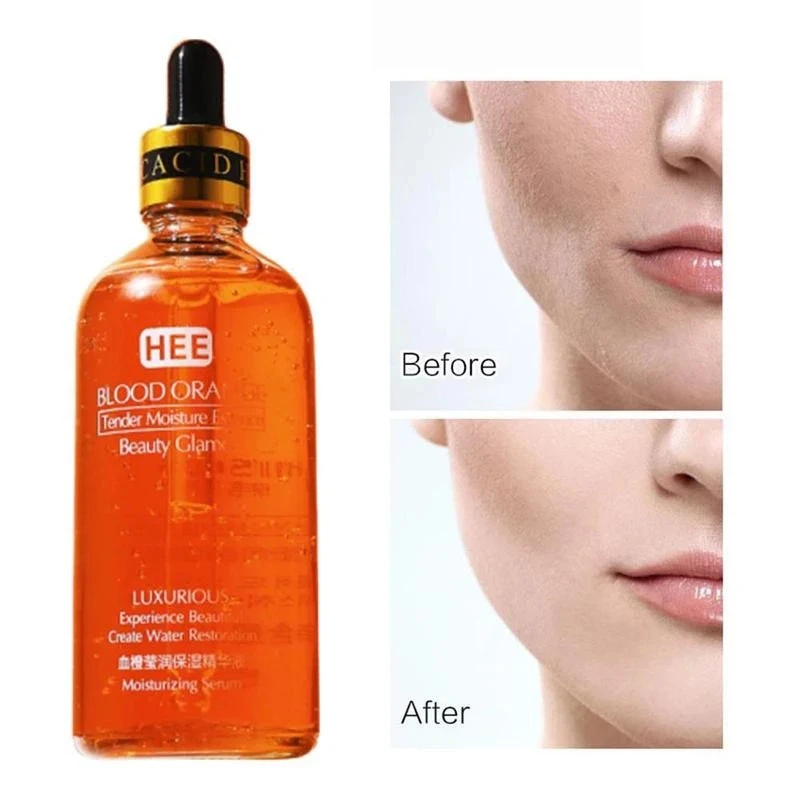 

100ml Blood Orange VC Essence Facial Serum Liquid Rich Vitamin C Whitening Freckle Moisture Face Care Beauty Antioxidation