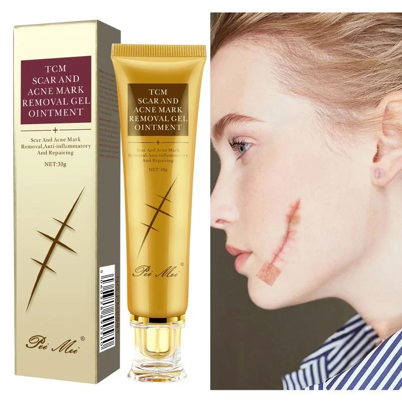 

Acne Scar Removal Cream Gel Face Pimples Stretch Marks Cream Repairing Smoothing Whitening Moisturizing Body Cream Skin Care 30g