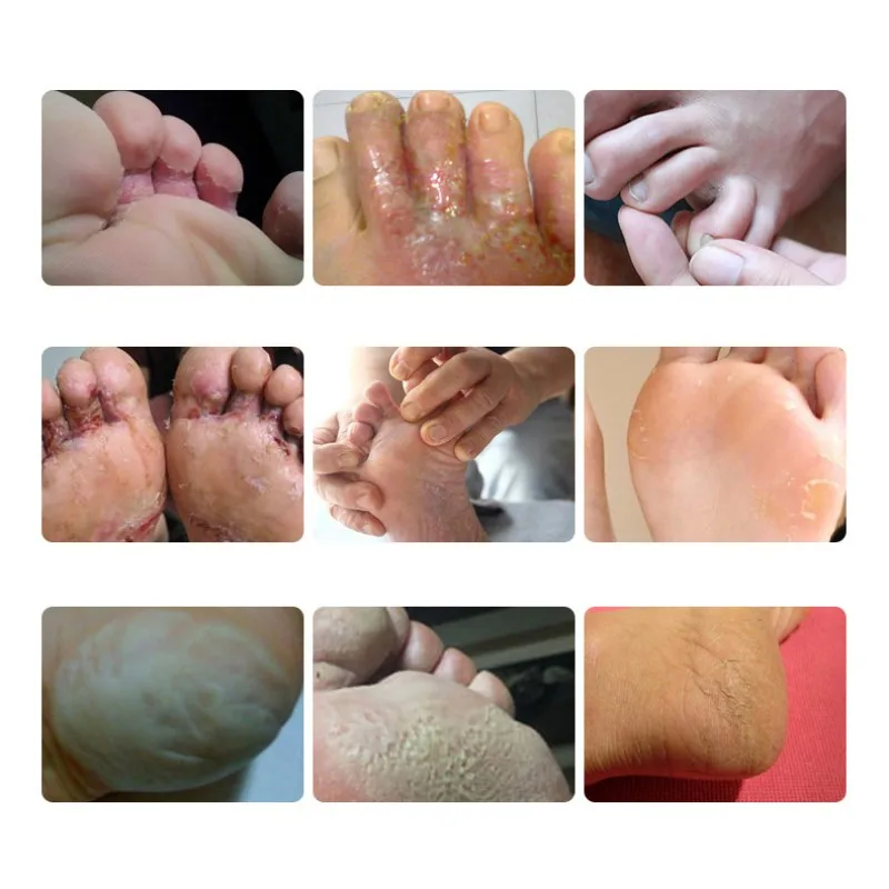 1 шт. натуральное страусиное масло крем против трещин и для ног восстанавливающий