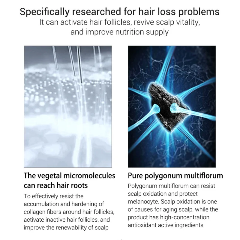 

30ml Fast Hair Growth Essential Oil Fleeceflower Root Ginger Extract Treatment Against Hair Loss Product Series