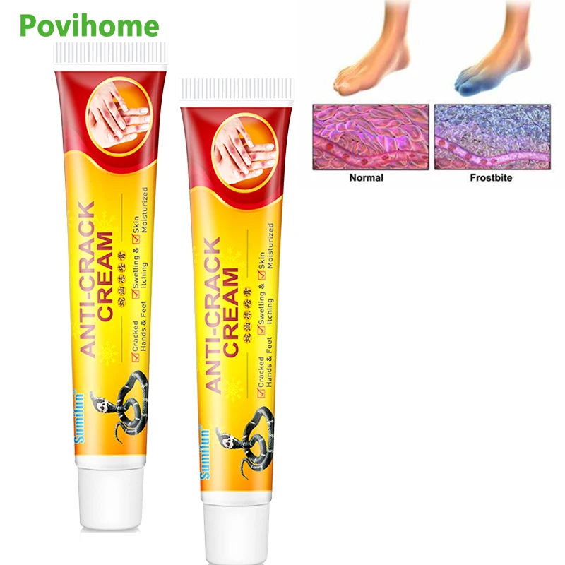 

Repairing Moisturizer Foot Cream Anti-chapping Skin For Rough Dry Cracked Chapped Feet Heel Hand Foot Cleft Healing Frostbite