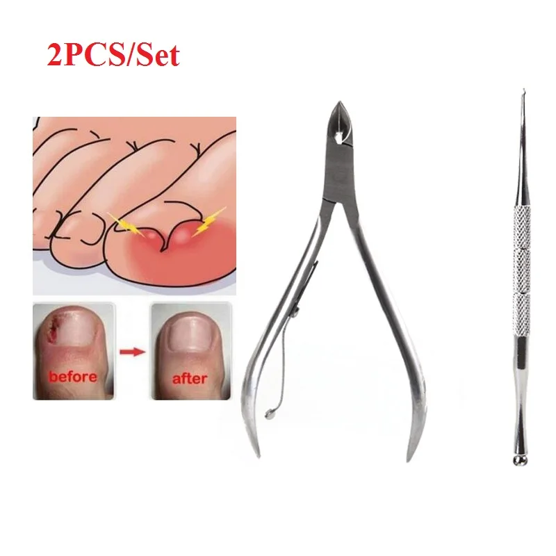2PCS/Set Ingrown Foot Care Tool Toe Nail Correction Nippers Clipper Cutters Dead Skin Dirt Remover Paronychia Podiatry Pedicure | Красота и