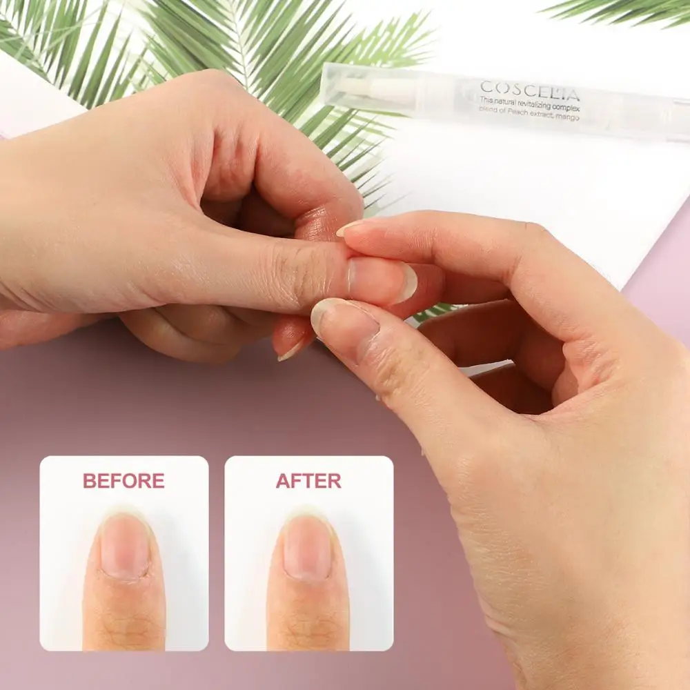 

COSCELIA 10pcs/set Nail Cuticle Oil Pen Nutrition Skin Treatment Oil For Manicure Flower Flavor Treatment Tool For Nails