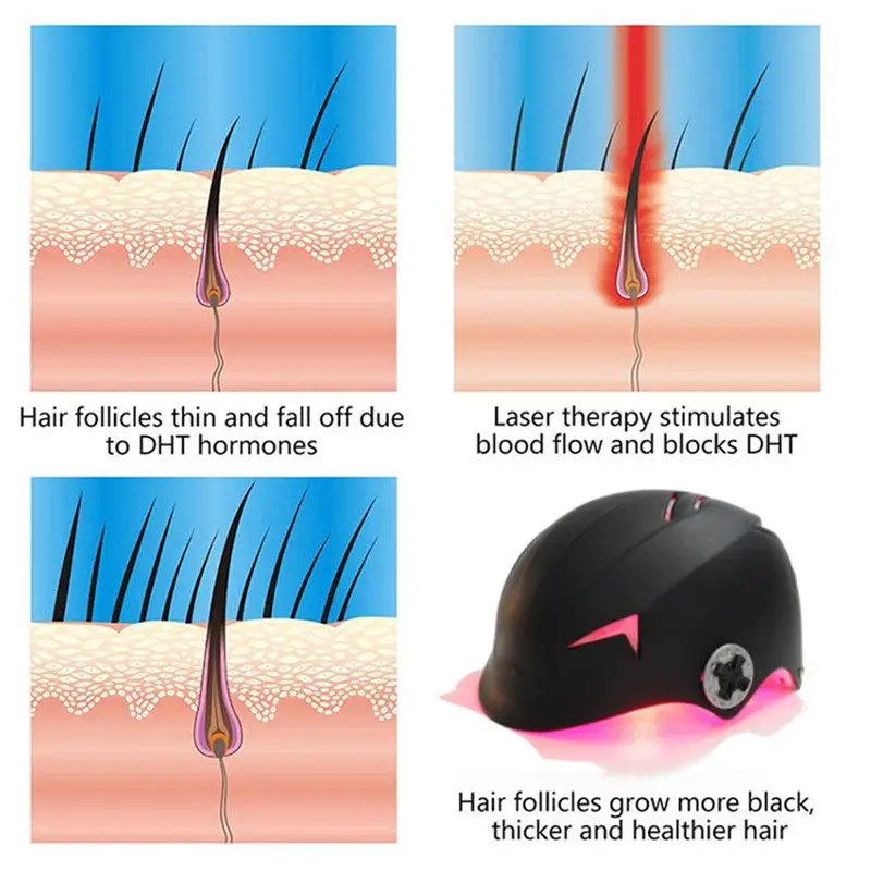 Колпачок для роста волос лазерный с 64 /128 диодами регулируемый|Средства от