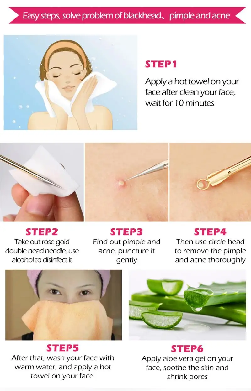 

LANBENA 4pc Rose Gold Acne needle Extractor Remover Blackhead Pimple Needles Blemish Treatment Skin Care Tool Pore Cleaner TSLM2
