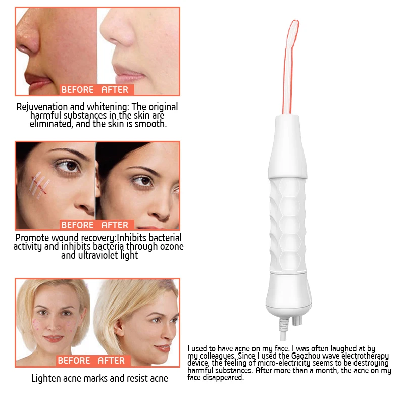 Модернизированный высокочастотный прибор для тока палочки электротерапии