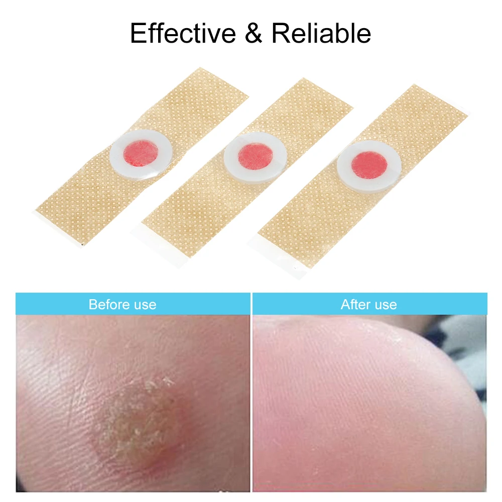 Средство для удаления мозолей средство бородавок подушечки 12/18/24 шт.|Инструмент