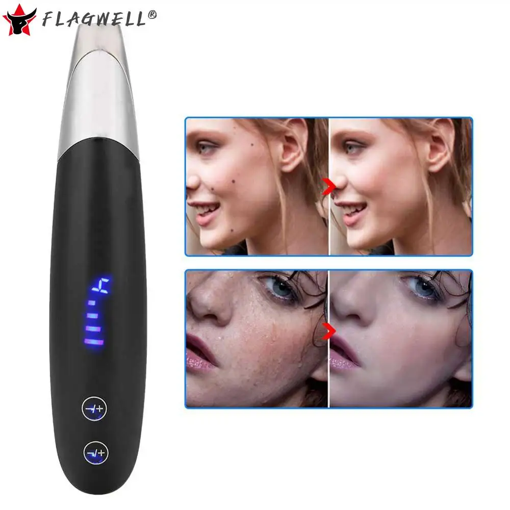 

Профессиональная лазерная ручка для удаления татуировок пикосекунда, многофункциональная машинка для удаления татуировок, веснушек, акне,...