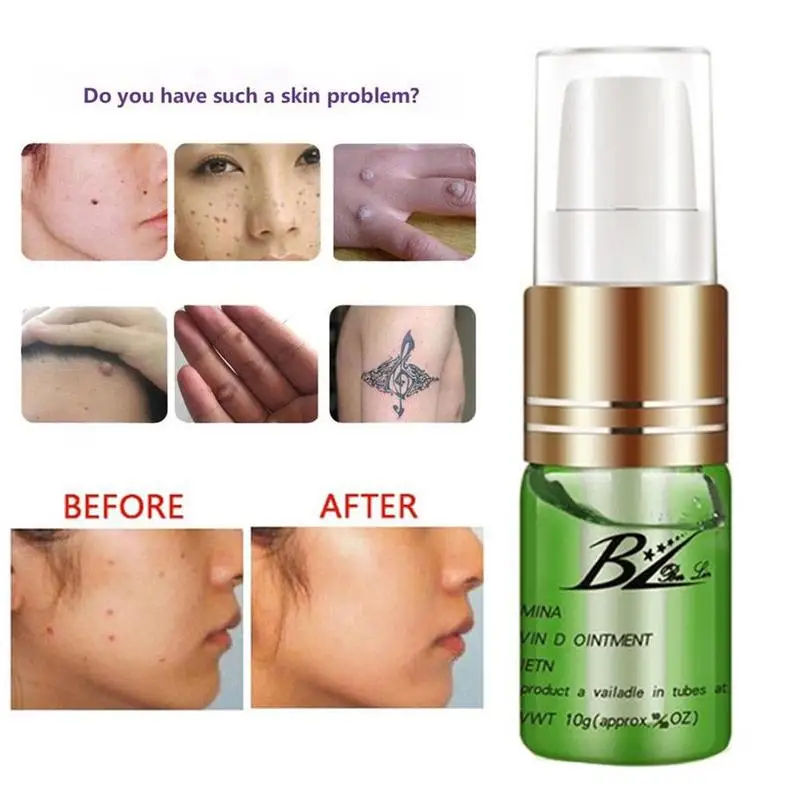 

tag Removal Cream Oil Solution Painless Mole Skin Dark Removal Freckle Removal Spot Face Tag Oil Wart Cream S6C3