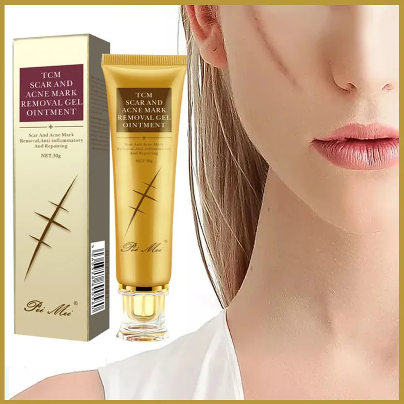 

Acne Scar Removal Face Cream Pimples Stretch Marks Gel Remove Acne Smoothing Whitening Moisturizing Body Skin Care Aichun 30g