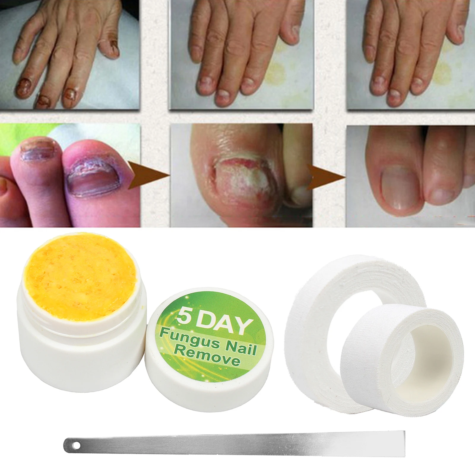 

Toe Nail Fungus Treatment Essence Nail Removal Solution Foot Care Tool