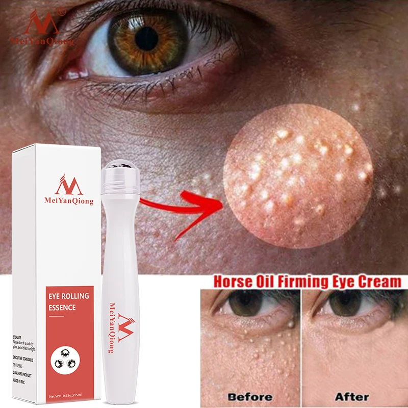 

Meiyanqiong Eye Serum Removal Wrinkle Contour Massager Anti Dark Circle Fade Fine Lines Remove Fat Particles Eye Bags Skin Care