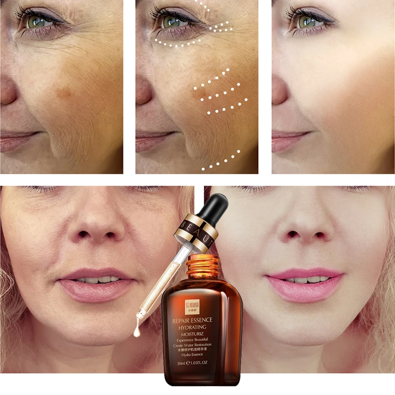 SENANA Advance Repair Сыворотка для лица Гиалуроновая кислота Омолаживающая Отбеливающая