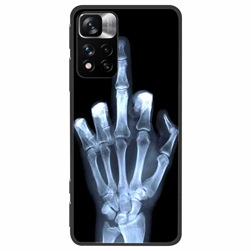 for poco m4 pro 5g case shockproof soft silicone tpu back cover for xiaomi poco m4 pro 5g phone cases poco m4pro 5g 2021 6 6 free global shipping
