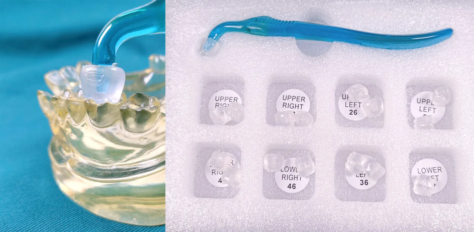 

1 коробка, стоматологическая форма для лечения света