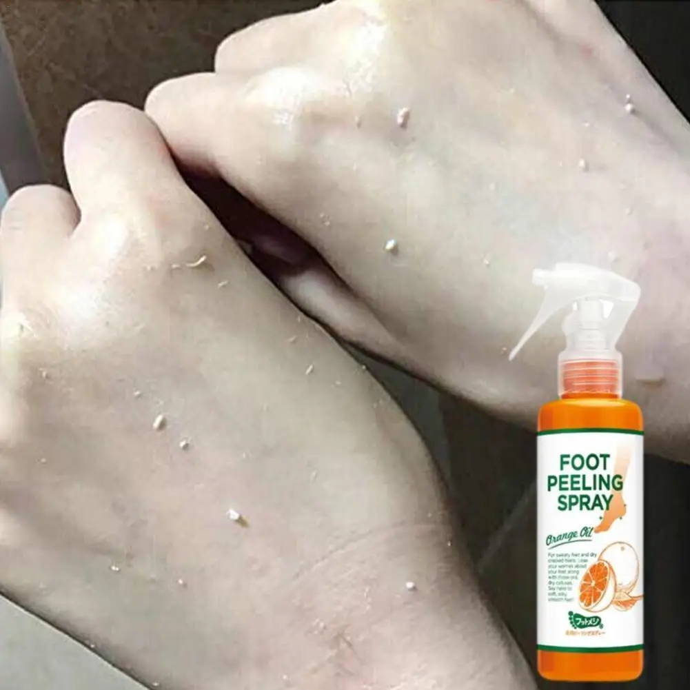 

110ml Foot Peeling Spray Natural Orange Essence Pedicure Hands Dead Skin Exfoliator Mask Whiten Baby Foot Care Tool Cosmetics